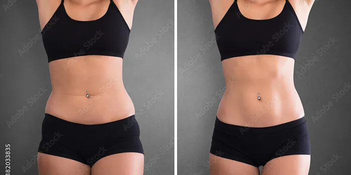 woman jogging on treadmill